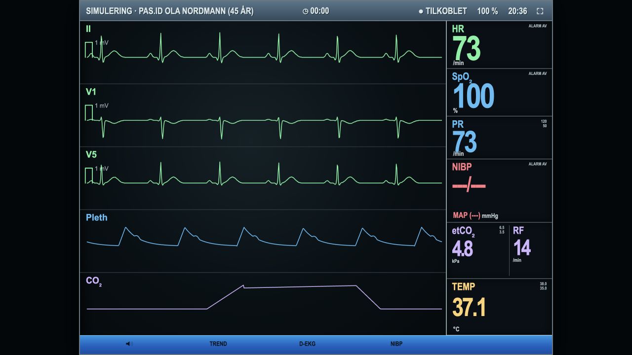 CaseSim-monitor med EKG i II, V1 og V5, pleth, kapnografi og vitale parametere